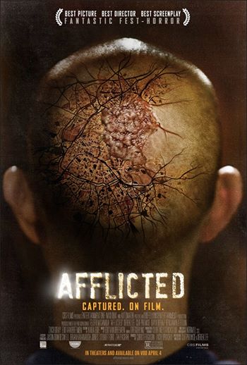 attachment
